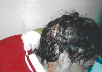 Illustration for article titled Hope You've Already Had Lunch: A Blood Week Blood Writes Gallery To Close Out Blood Week